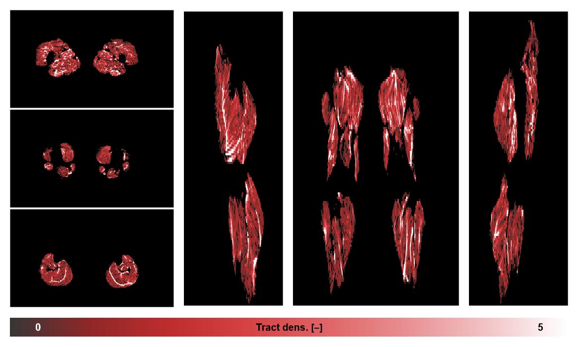 Muscle fiber tract density map based on whole leg DTI based fiber tractography.