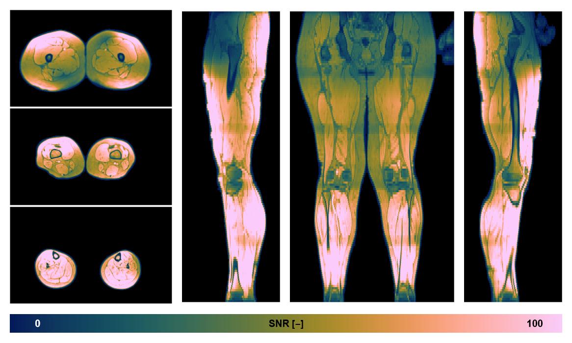 The SNR distribution of the dixon data.