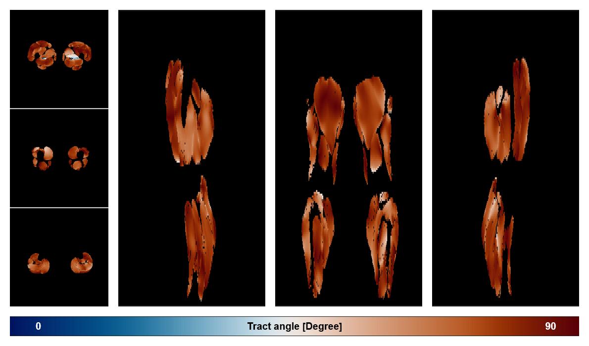 Muscle fiber tract angle map based on whole leg DTI based fiber tractography.