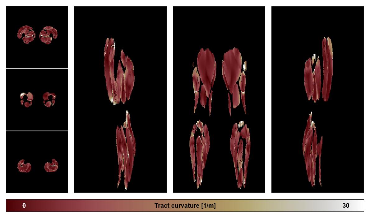 Muscle fiber tract curvature map based on whole leg DTI based fiber tractography.