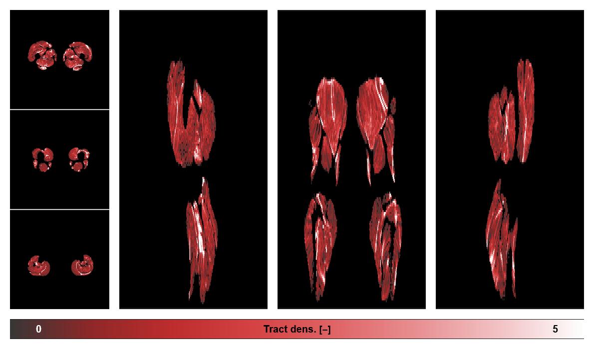 Muscle fiber tract density map based on whole leg DTI based fiber tractography.