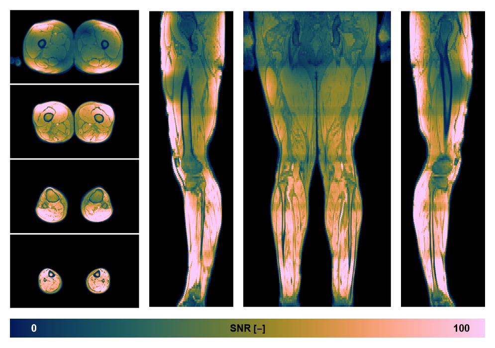 The SNR distribution of the dixon data.