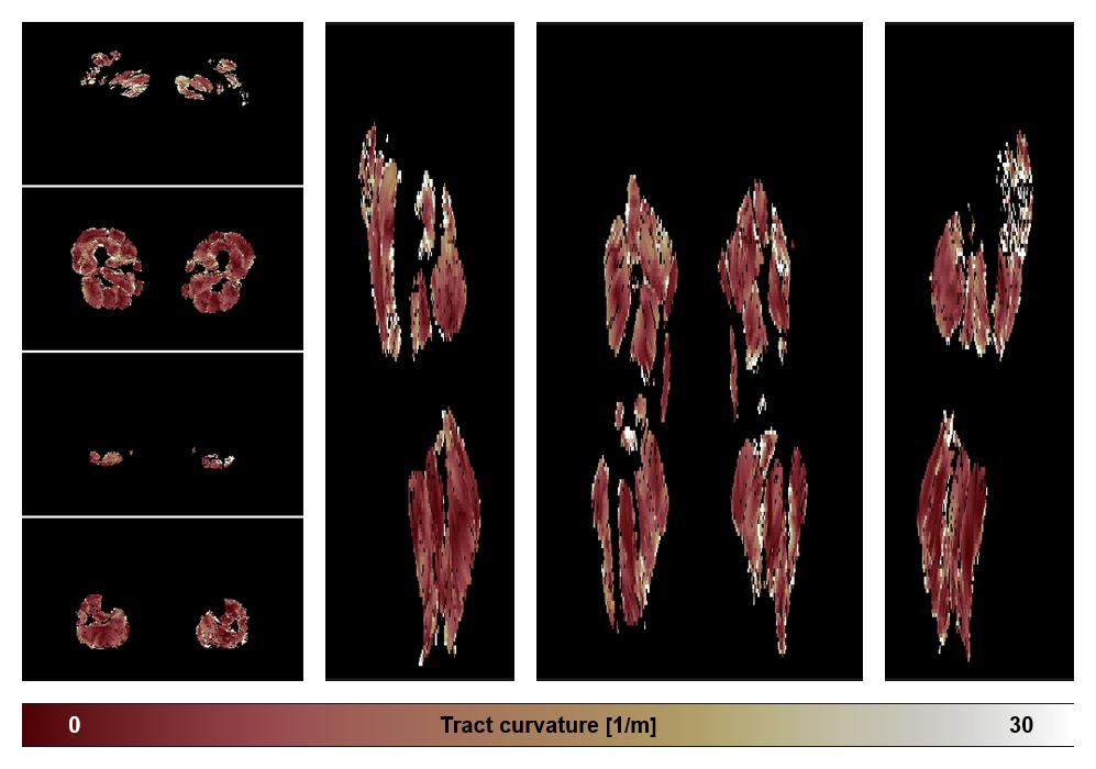Muscle fiber tract curvature map based on whole leg DTI based fiber tractography.