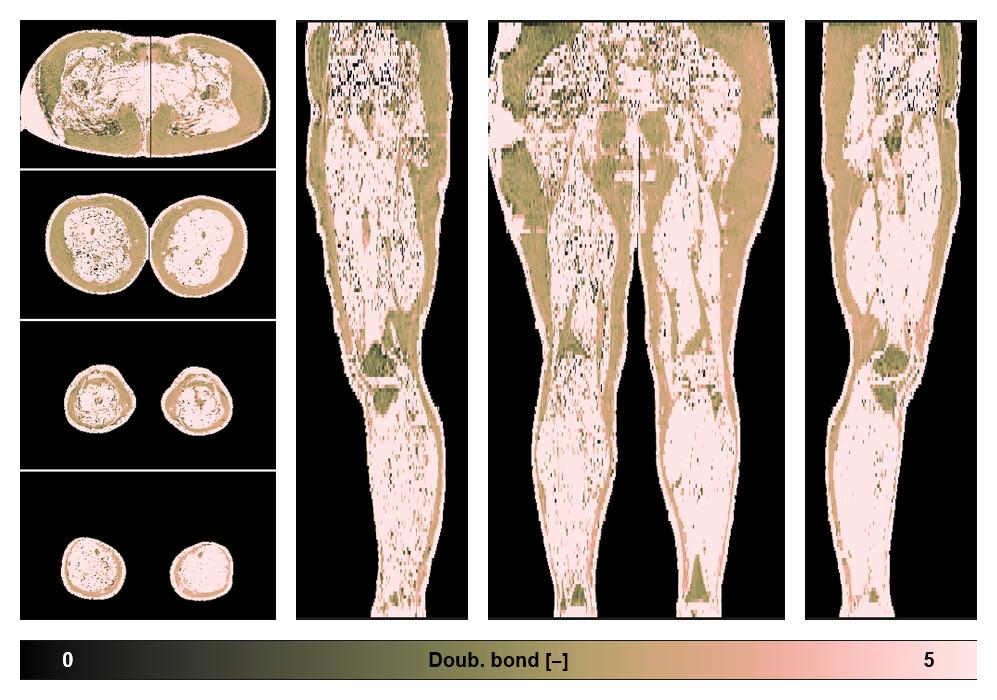 Number of double bonds in subcutanious fat.