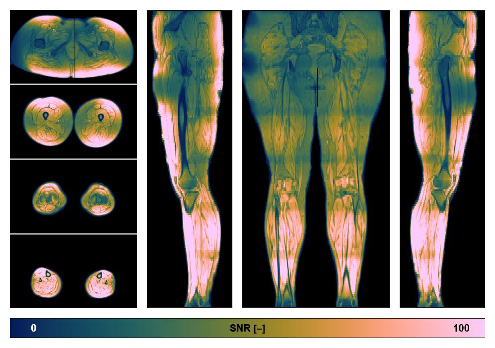 The SNR distribution of the dixon data.