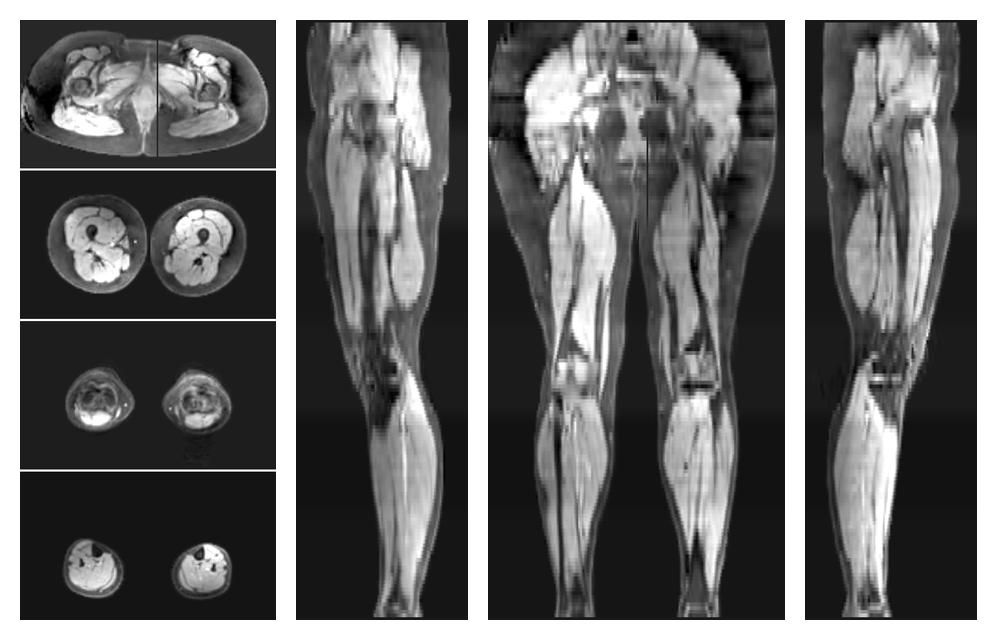 The water part of the acquired multi-echo spin echo data.