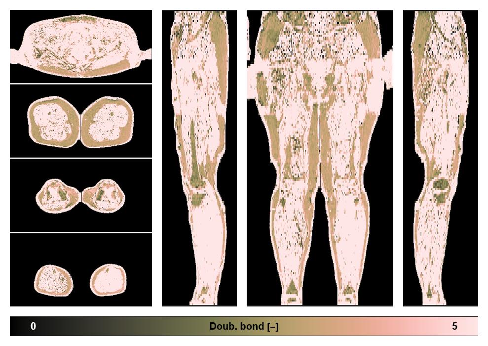 Number of double bonds in subcutanious fat.