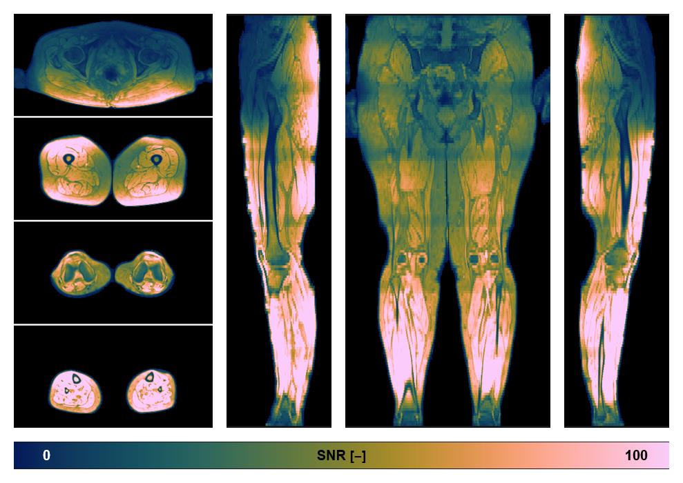 The SNR distribution of the dixon data.