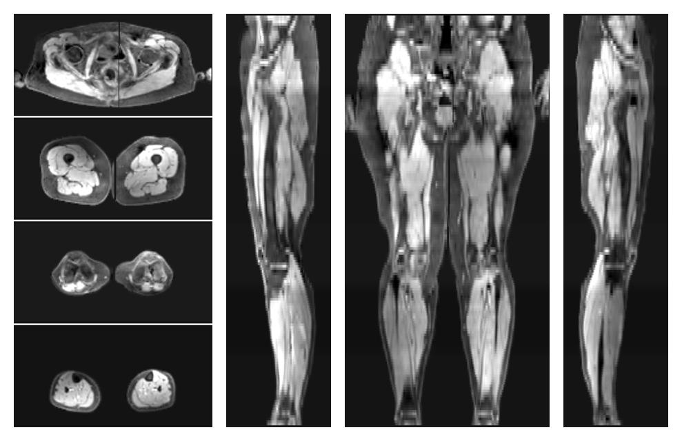 The water part of the acquired multi-echo spin echo data.