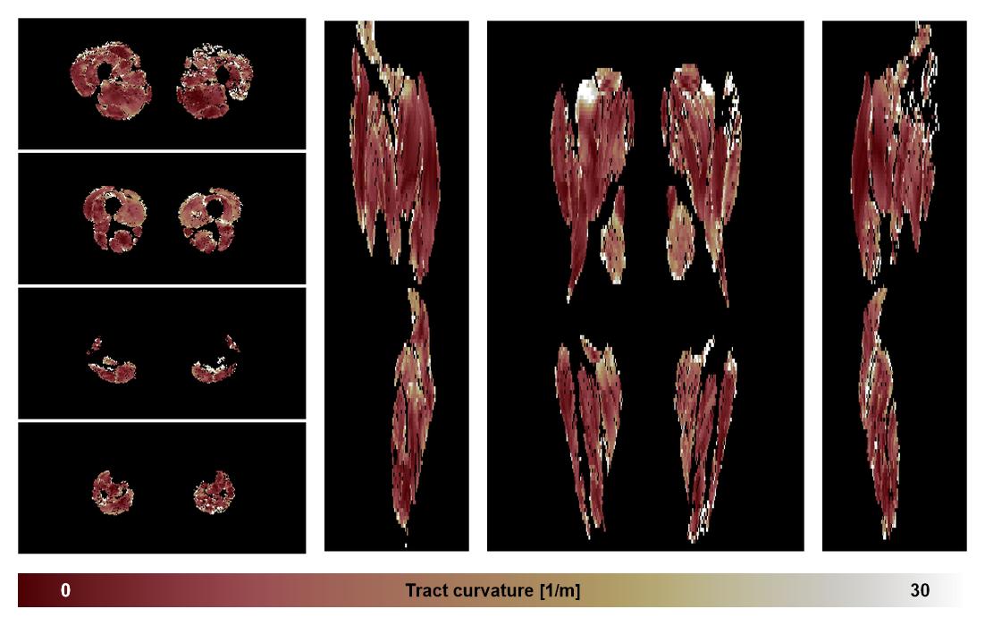 Muscle fiber tract curvature map based on whole leg DTI based fiber tractography.