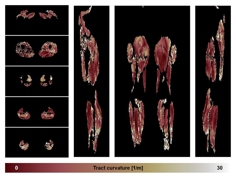 Muscle fiber tract curvature map based on whole leg DTI based fiber tractography.