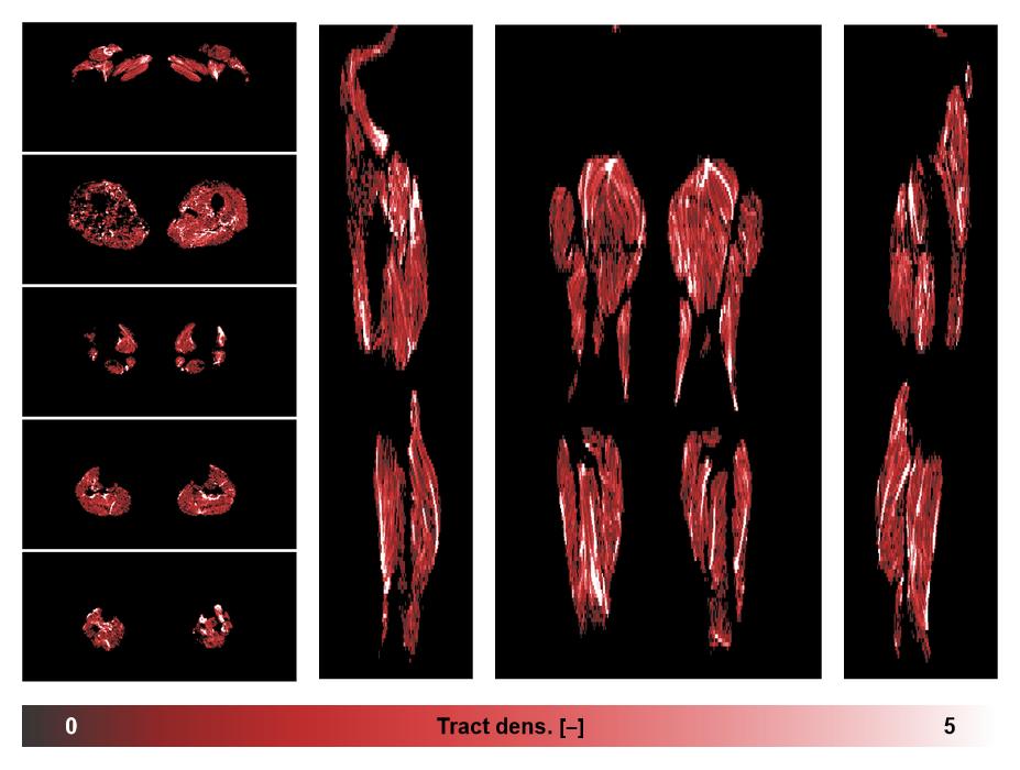 Muscle fiber tract density map based on whole leg DTI based fiber tractography.