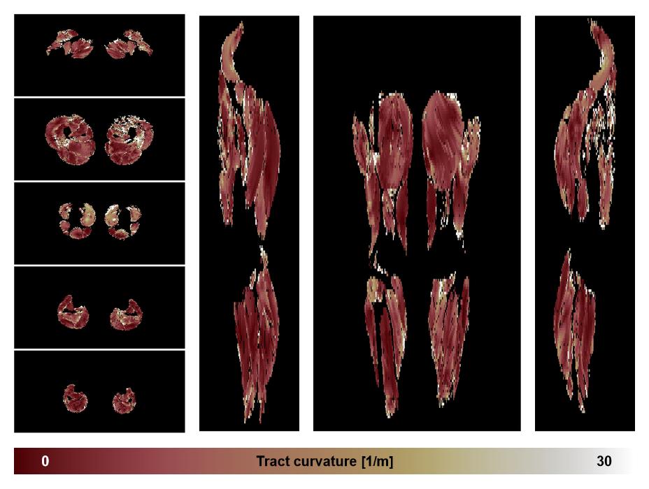 Muscle fiber tract curvature map based on whole leg DTI based fiber tractography.