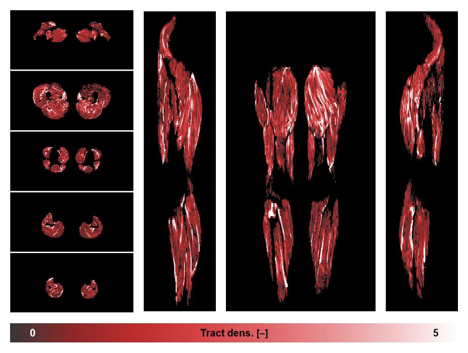 Muscle fiber tract density map based on whole leg DTI based fiber tractography.