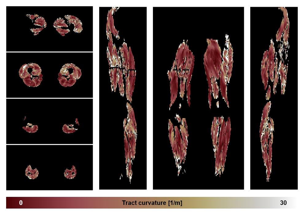 Muscle fiber tract curvature map based on whole leg DTI based fiber tractography.