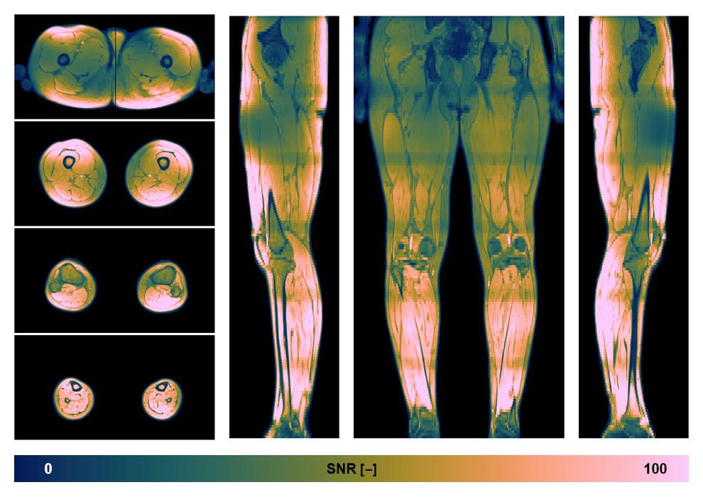 The SNR distribution of the dixon data.