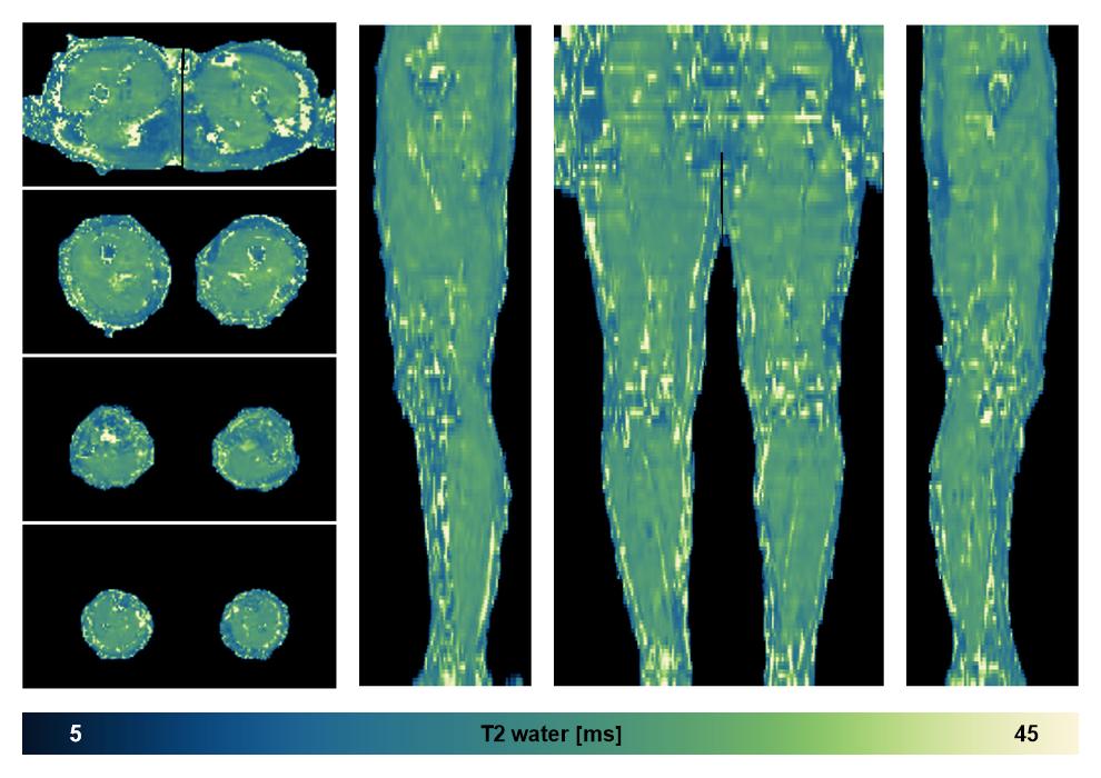 The water only T2 relaxation time of the lower extremity obtained from multi echo spin echo t2 mapping with EPG based reconstruction.