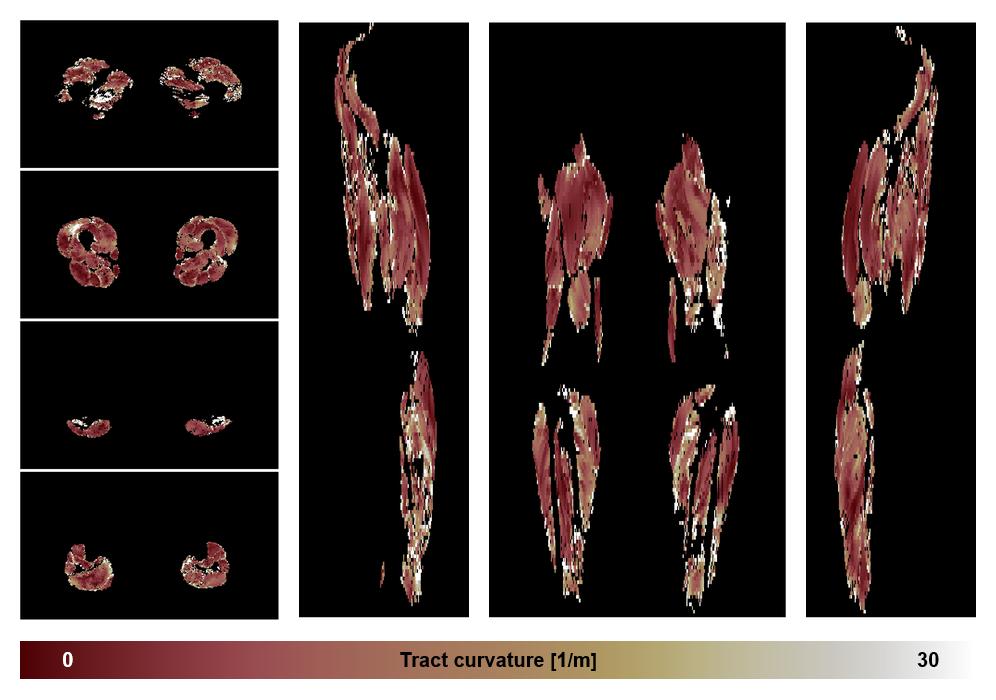 Muscle fiber tract curvature map based on whole leg DTI based fiber tractography.