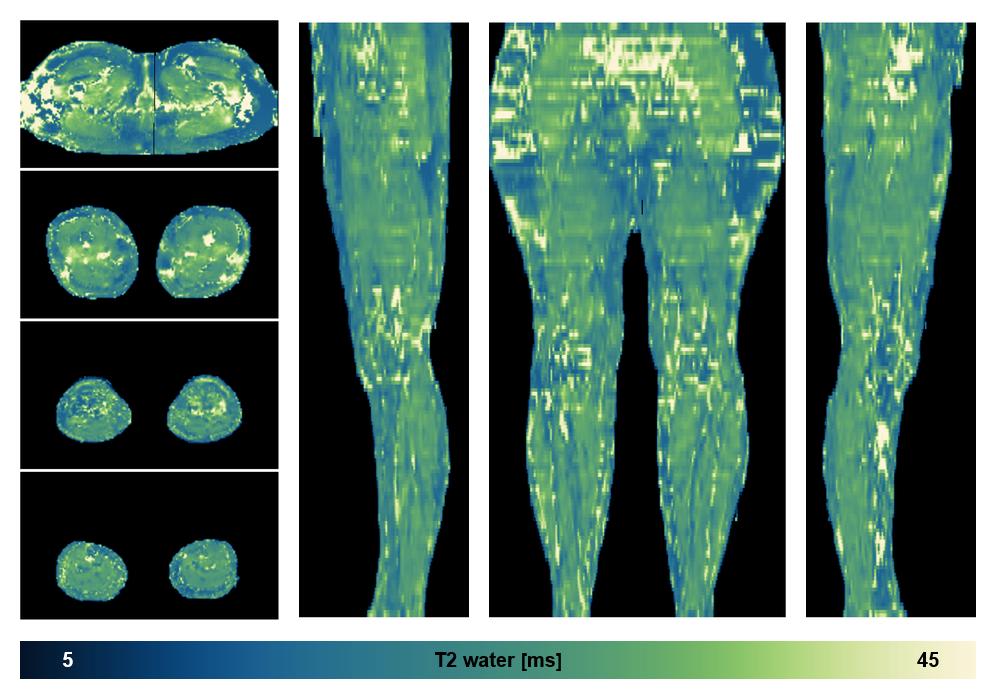 The water only T2 relaxation time of the lower extremity obtained from multi echo spin echo t2 mapping with EPG based reconstruction.