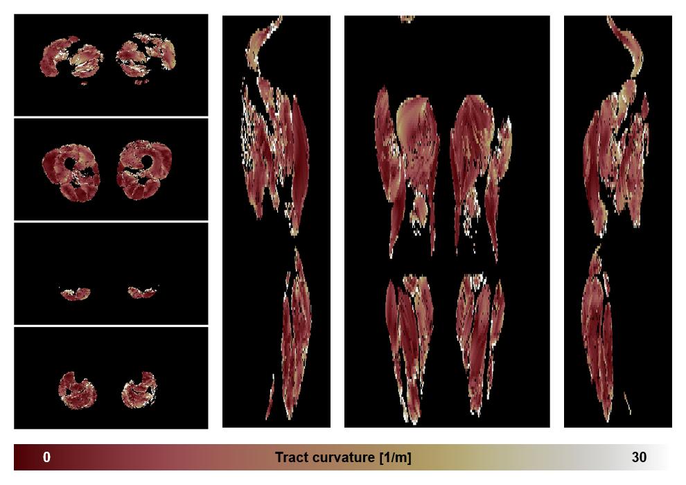 Muscle fiber tract curvature map based on whole leg DTI based fiber tractography.
