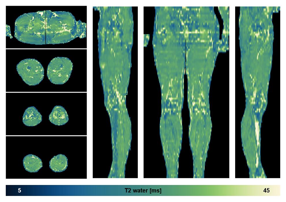 The water only T2 relaxation time of the lower extremity obtained from multi echo spin echo t2 mapping with EPG based reconstruction.