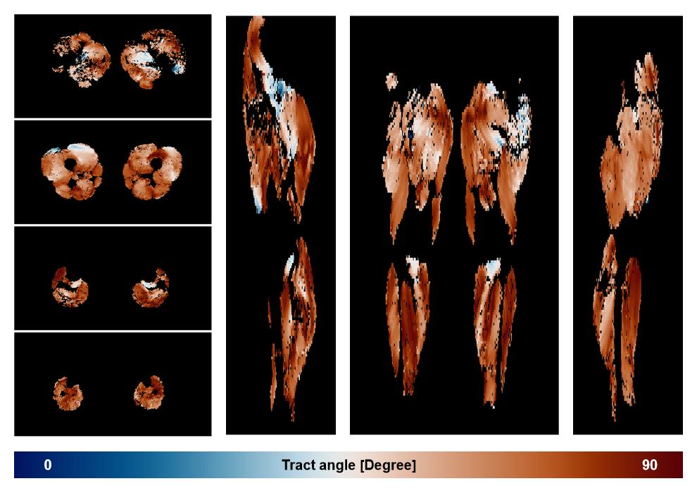 Muscle fiber tract angle map based on whole leg DTI based fiber tractography.