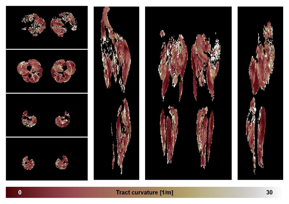 Muscle fiber tract curvature map based on whole leg DTI based fiber tractography.