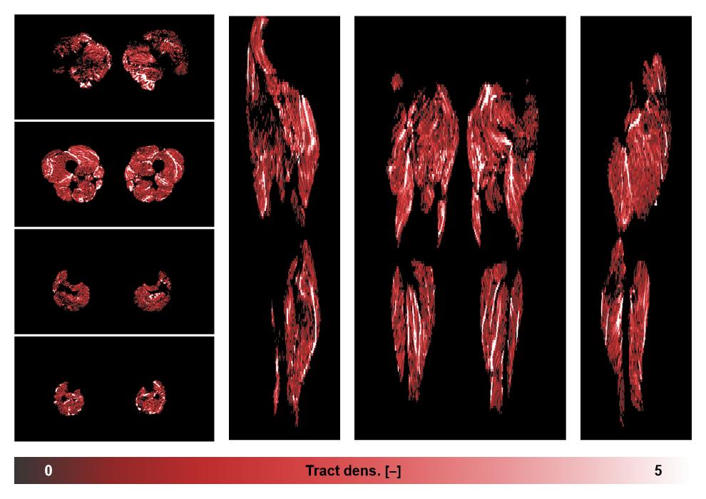 Muscle fiber tract density map based on whole leg DTI based fiber tractography.