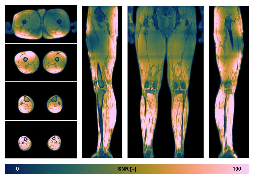 The SNR distribution of the dixon data.