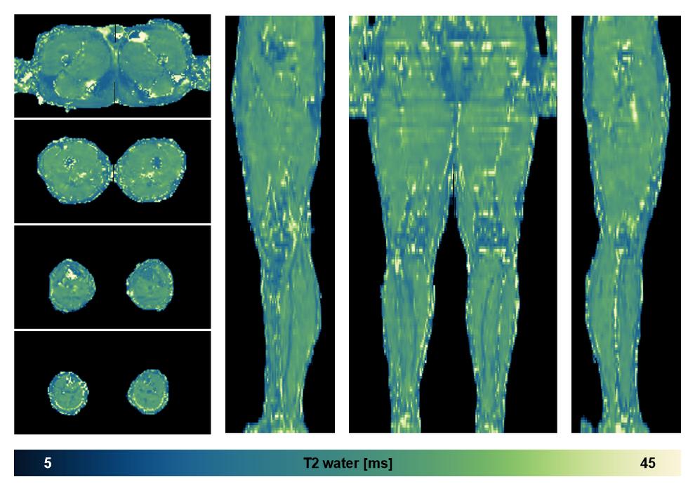 The water only T2 relaxation time of the lower extremity obtained from multi echo spin echo t2 mapping with EPG based reconstruction.