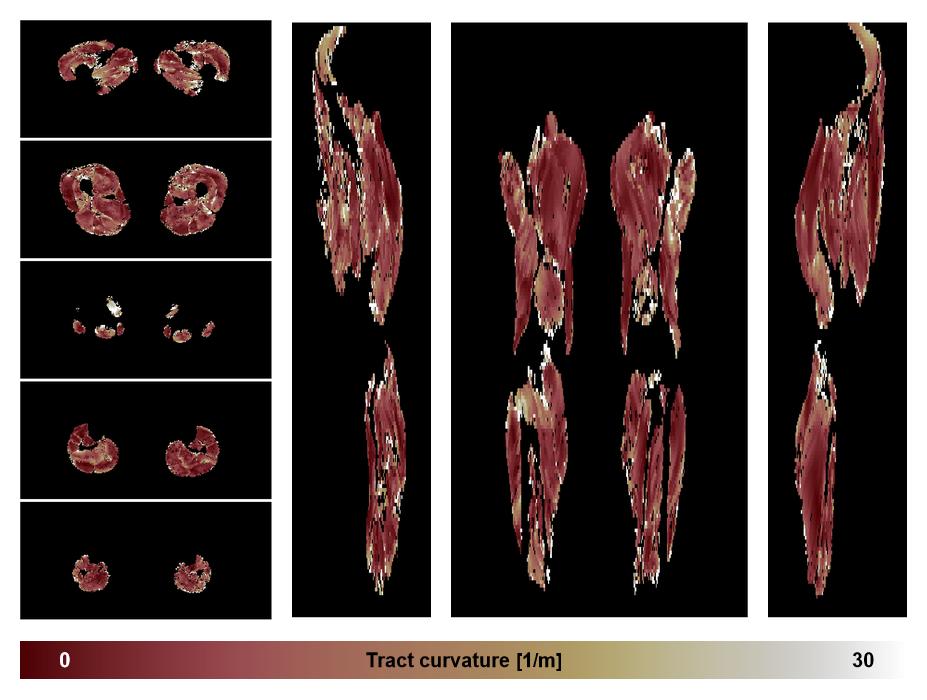 Muscle fiber tract curvature map based on whole leg DTI based fiber tractography.