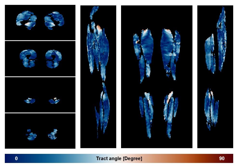 Muscle fiber tract angle map based on whole leg DTI based fiber tractography.