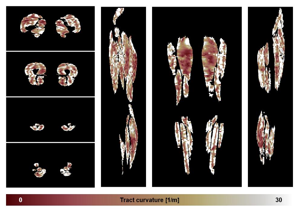 Muscle fiber tract curvature map based on whole leg DTI based fiber tractography.