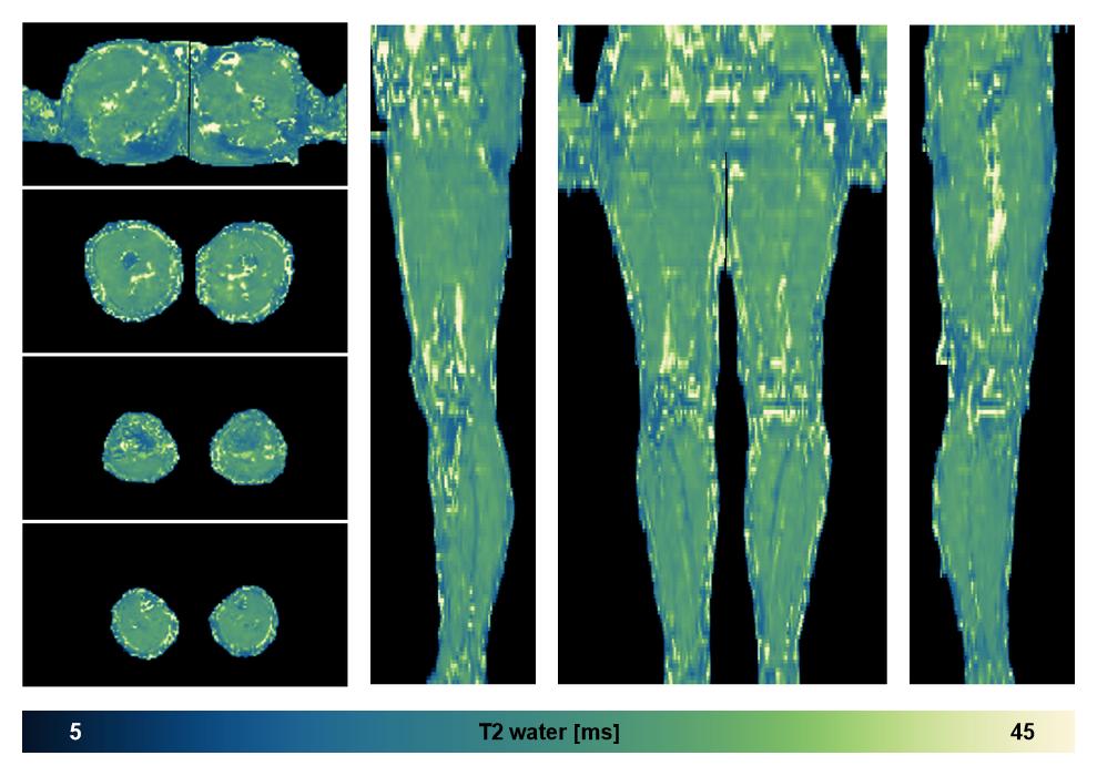 The water only T2 relaxation time of the lower extremity obtained from multi echo spin echo t2 mapping with EPG based reconstruction.