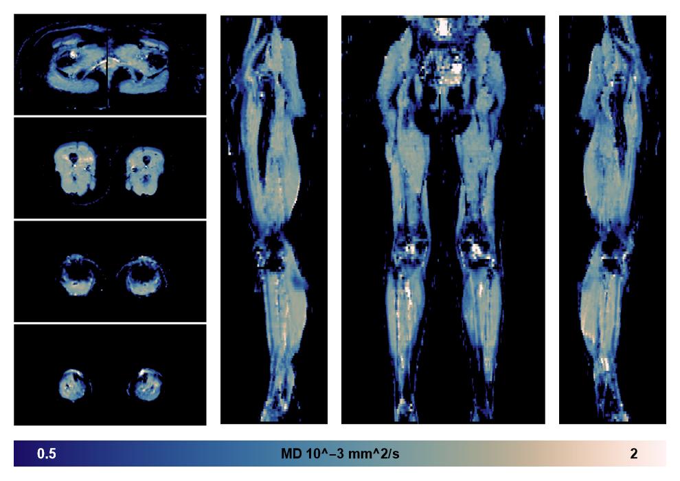 IVIM corrected whole leg muscle mean diffusivity obtained from diffusion tensor imaging.