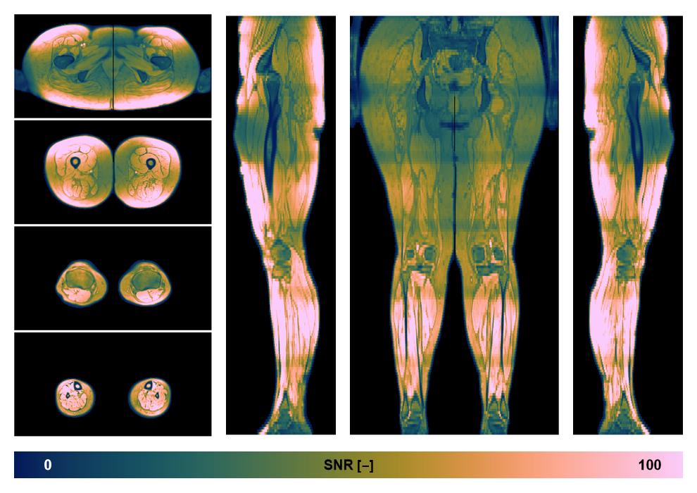 The SNR distribution of the dixon data.