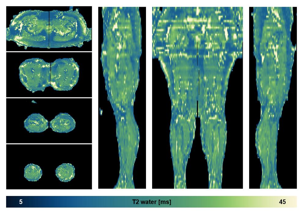 The water only T2 relaxation time of the lower extremity obtained from multi echo spin echo t2 mapping with EPG based reconstruction.