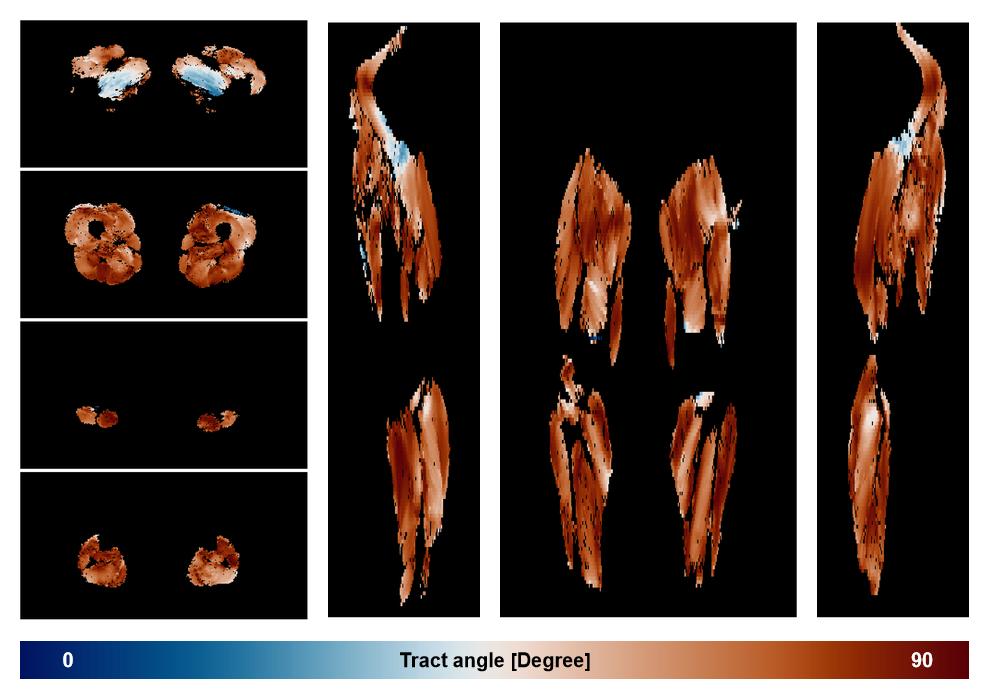 Muscle fiber tract angle map based on whole leg DTI based fiber tractography.