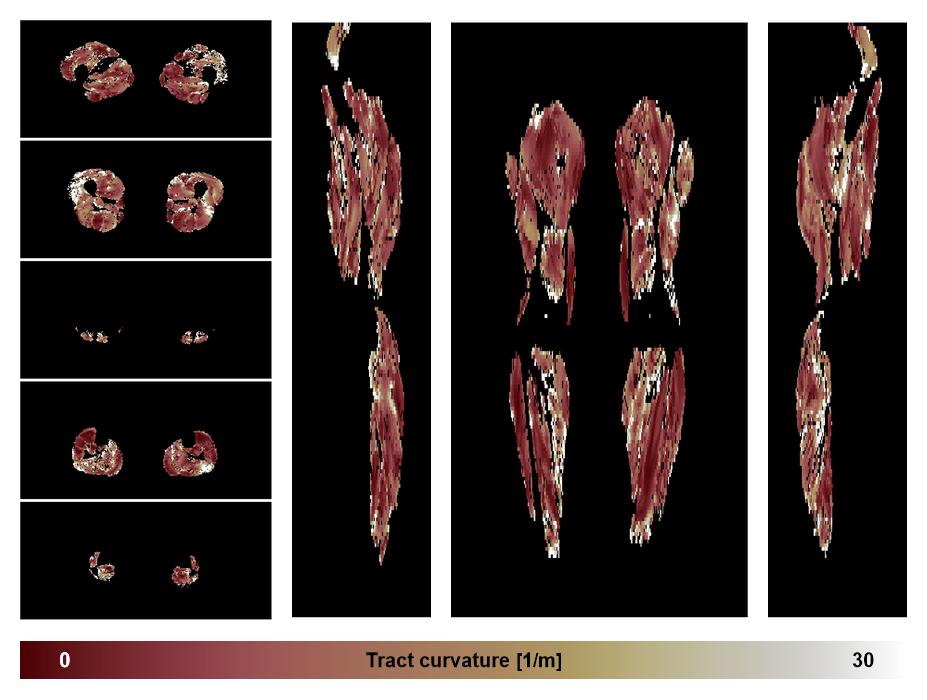 Muscle fiber tract curvature map based on whole leg DTI based fiber tractography.