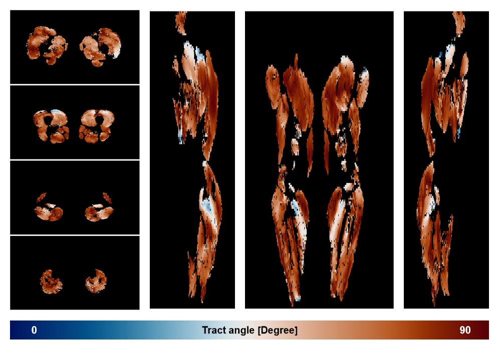 Muscle fiber tract angle map based on whole leg DTI based fiber tractography.