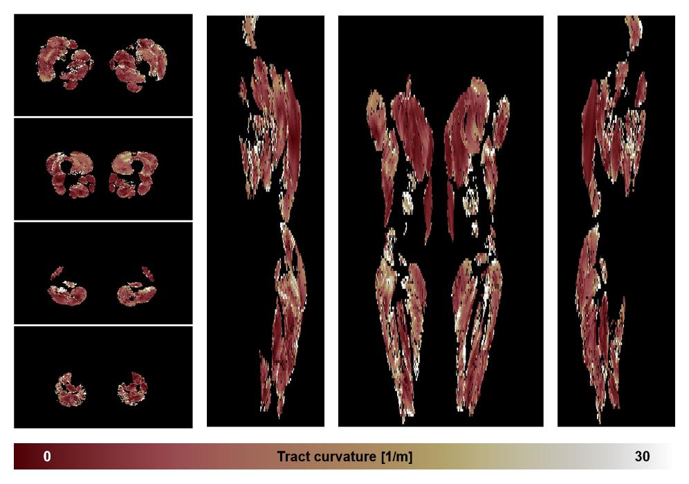 Muscle fiber tract curvature map based on whole leg DTI based fiber tractography.