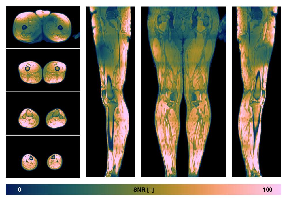 The SNR distribution of the dixon data.