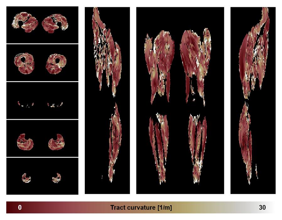 Muscle fiber tract curvature map based on whole leg DTI based fiber tractography.