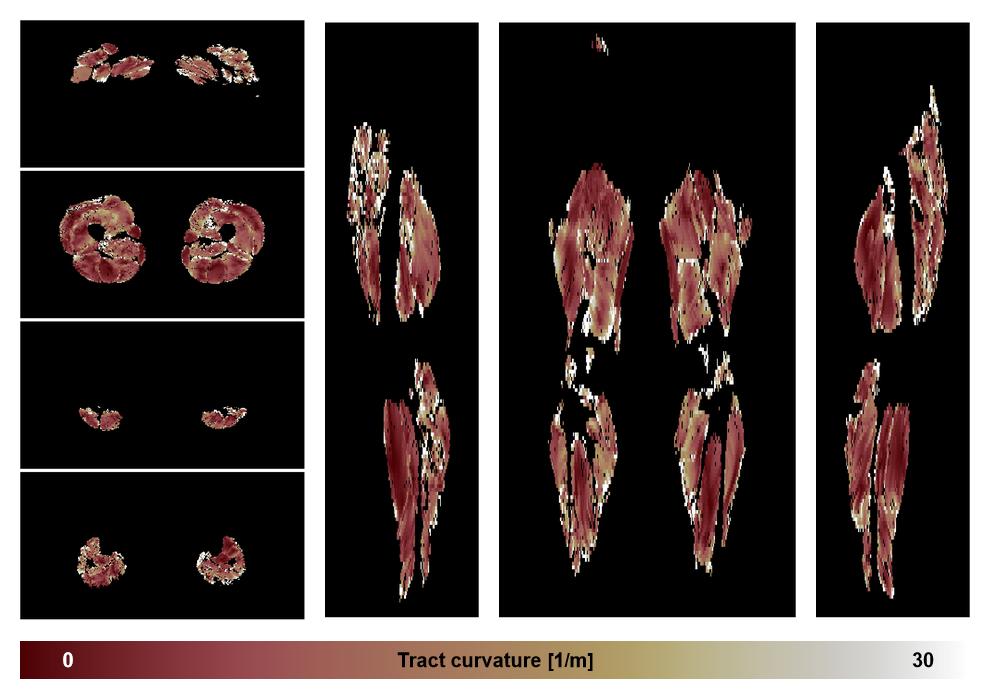 Muscle fiber tract curvature map based on whole leg DTI based fiber tractography.