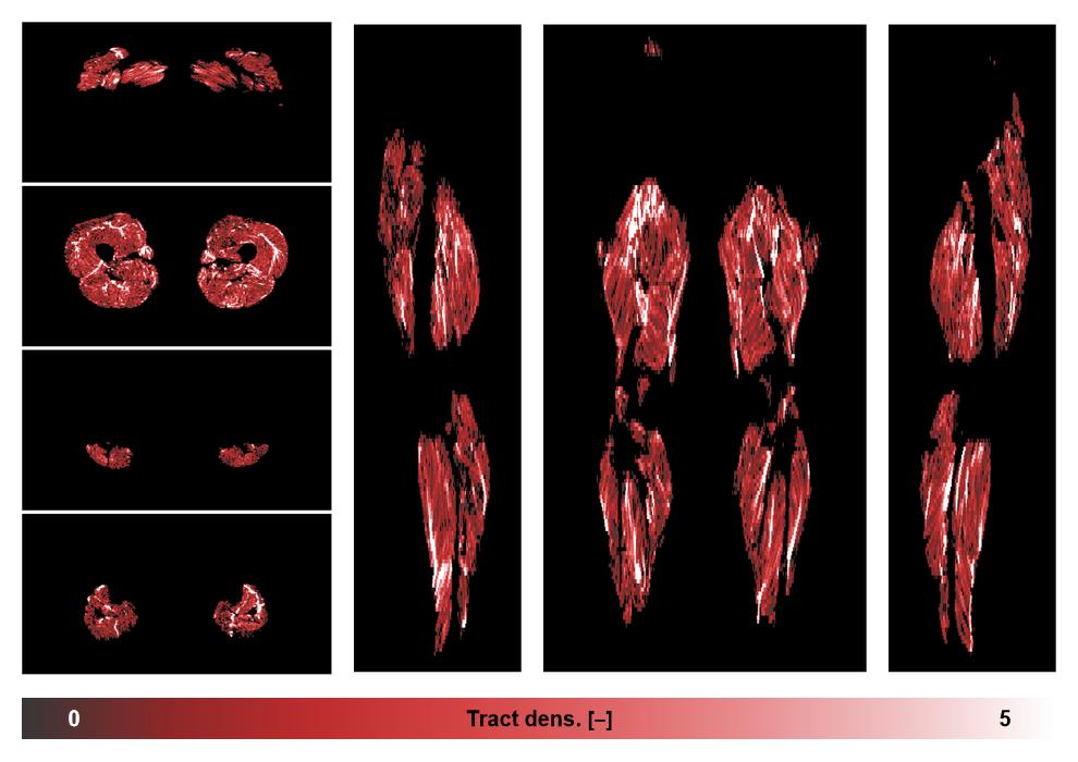 Muscle fiber tract density map based on whole leg DTI based fiber tractography.