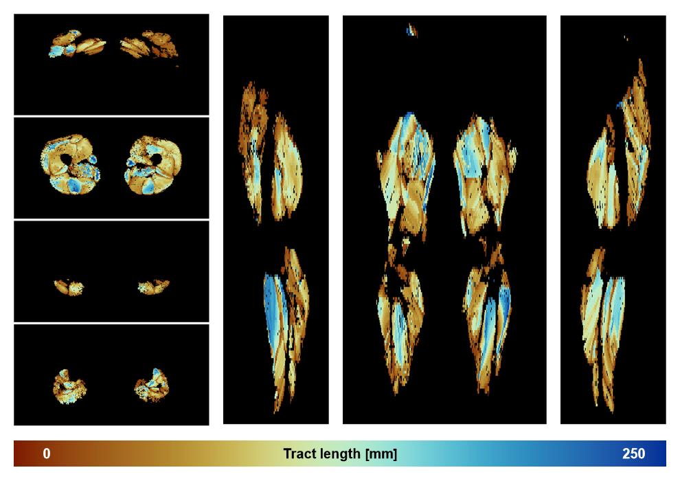 Muscle fiber tract length map based on whole leg DTI based fiber tractography.