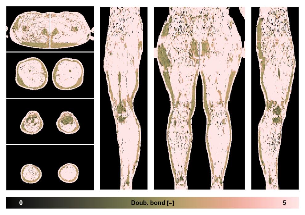 Number of double bonds in subcutanious fat.