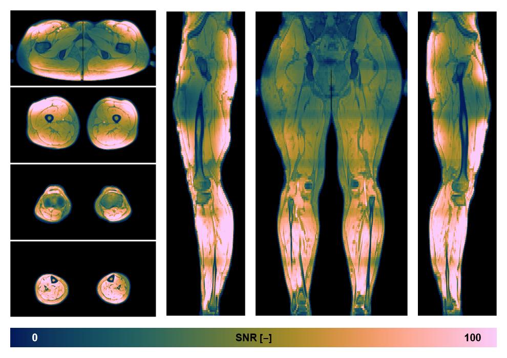 The SNR distribution of the dixon data.