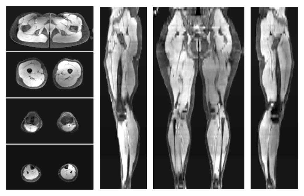 The water part of the acquired multi-echo spin echo data.