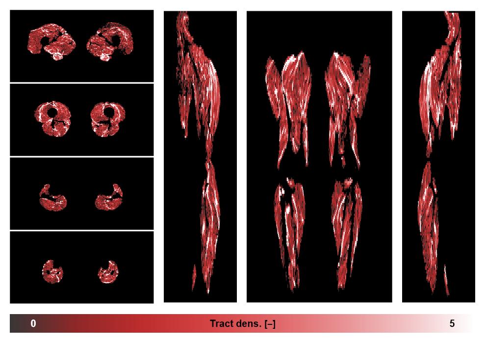Muscle fiber tract density map based on whole leg DTI based fiber tractography.